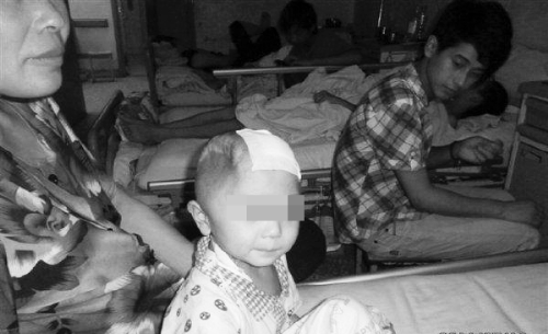 河南一4岁男童被继母“打瘪”半边脑袋致偏瘫(图)