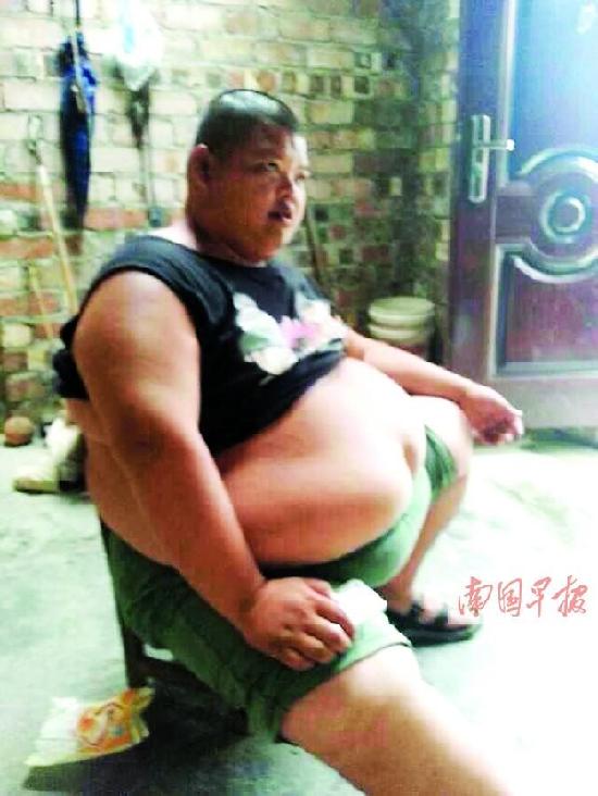 男子单纯性肥胖320余斤 曾为爱减肥30斤(图)