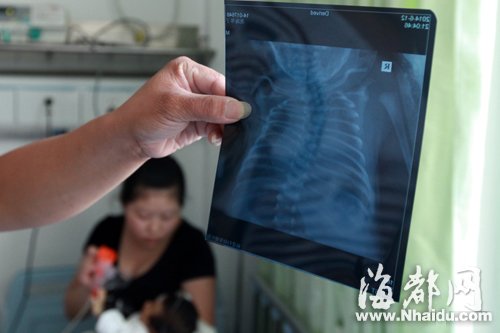 罗源:新生儿多长三根肋骨 多病缠身急盼援手