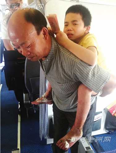 父子均患红斑性肢痛症 南航机组飞机上发起募捐
