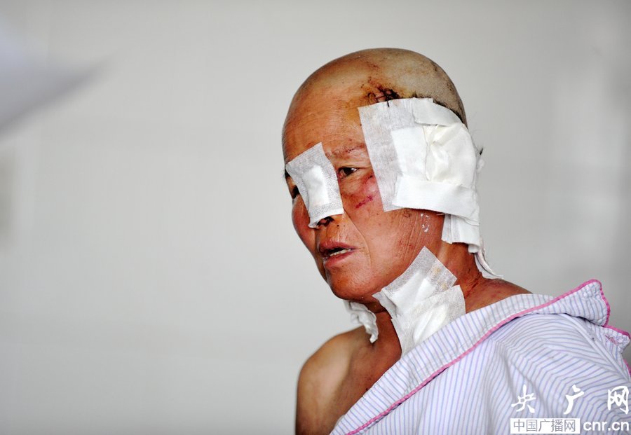 新疆发生狼群袭人事件 6人受伤1人耳朵被咬掉