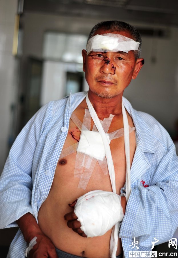 新疆发生狼群袭人事件 6人受伤1人耳朵被咬掉
