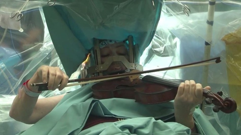 小提琴手脑手术时淡定拉奏