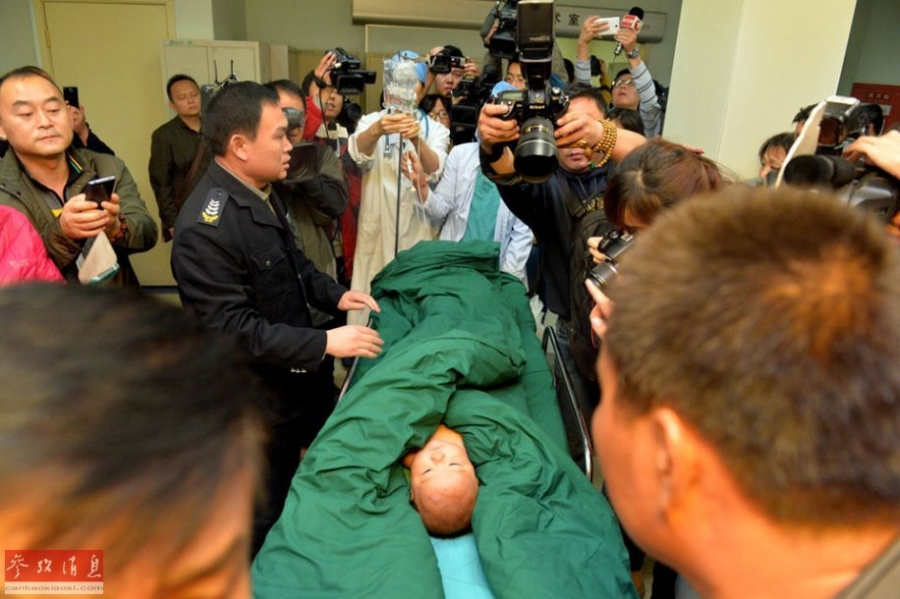 被针扎女婴12根针全部取出 10根为注射针头