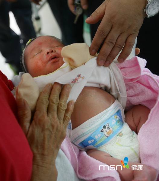 新生男婴腹中藏一胎儿 实拍手术