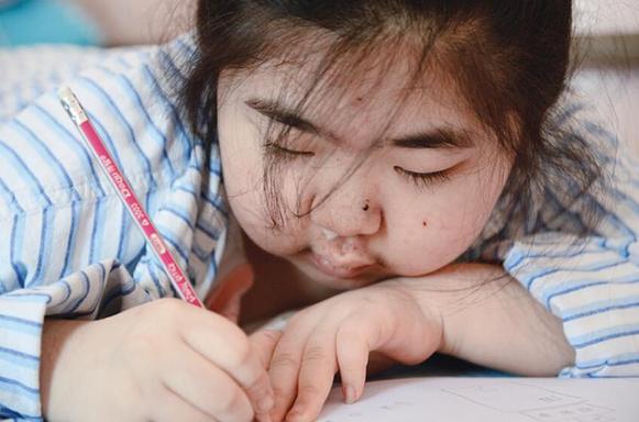 宾县8岁白血病女孩李红畅有个心愿“我好想去学校上堂课”
