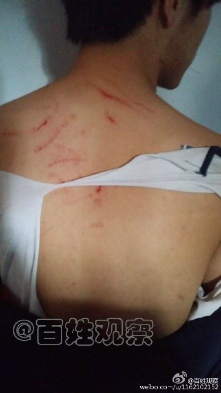 郑州多名女老师与男学生互殴 致一名老师流产