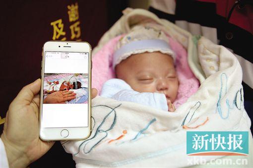 广东最“袖珍”早产宝宝诞生 体重仅550克