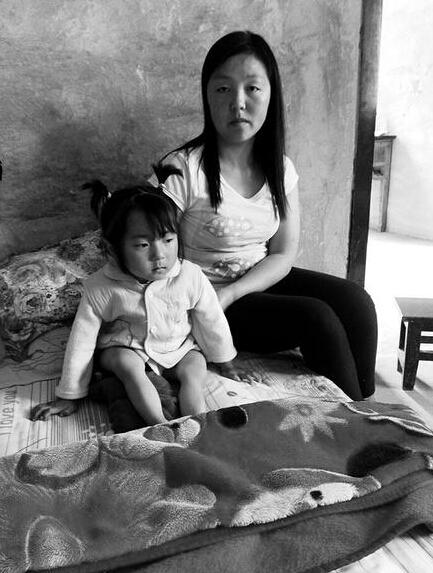 陕西宁强4岁“玻璃娃娃”出生至今已骨折40多次