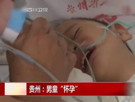 两岁半男婴竟然怀孕 剖腹产手术取出腹中胎儿