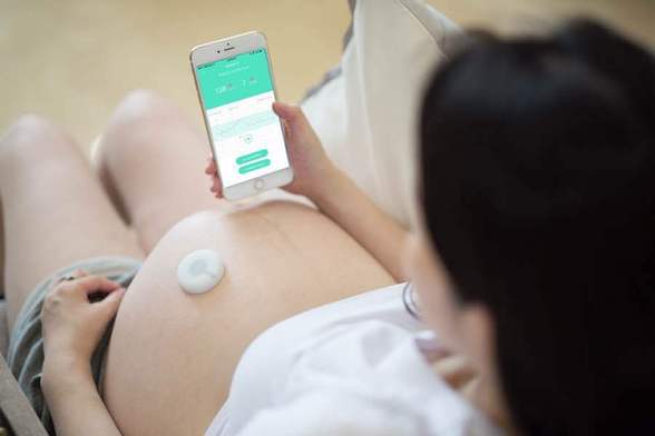 全球首款被动式胎心胎动检测仪在苏州正式发布