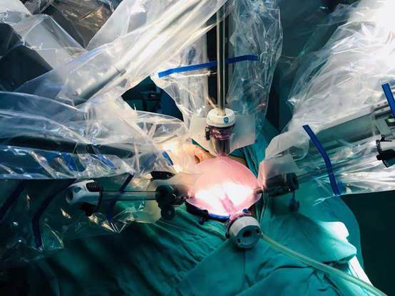 甘青宁新首例达芬奇机器人单孔腹腔镜下宫颈癌根治术落幕甘肃省人民医院