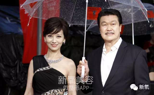 62岁“励志婆婆”为了见初恋，整容成16岁赵雅芝
