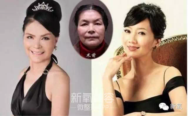 62岁“励志婆婆”为了见初恋，整容成16岁赵雅芝