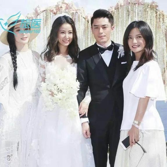 霍心大婚刚过,林心如竟被曝出整容传闻?!