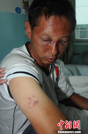 西宁警察处警被城管打伤枪险被抢 当地调查(图)