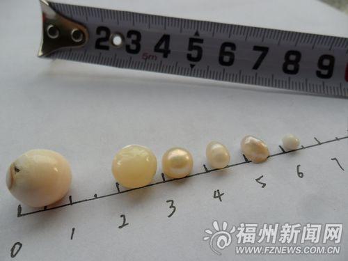女子将1颗珍珠放糯米中9年“生”出5颗小珍珠